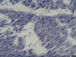 Células musculares sanas de un corazón humano