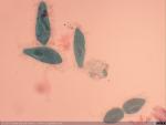 Protozoo Paramecio. Detalle de mitosis