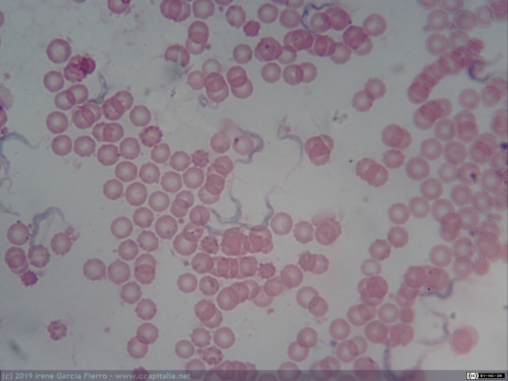 Tripanosoma. Protozoo unicelular causante de la enfermedad del sueño infectando sangre humana