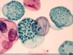 Volvox. Alga pluricelular