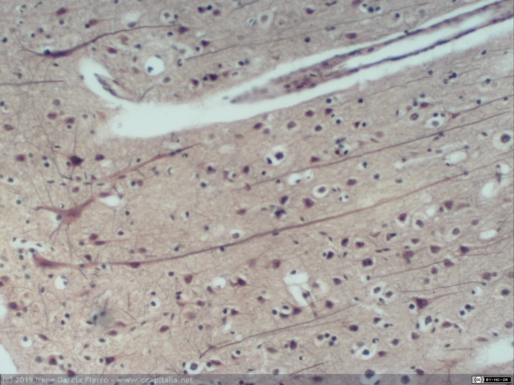 Tejido cerebral de un humano sano y detalle de neurona
