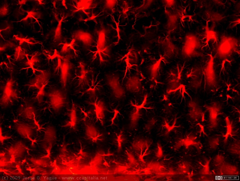 Mo12 hipo intacto CA1 arriba y radiatum de CA1 abajo GFAP 20x otra