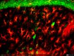 Mo12 hipo lesion CA1 arriba y radiatum de CA1 abajo acris y GFAP 20x otra