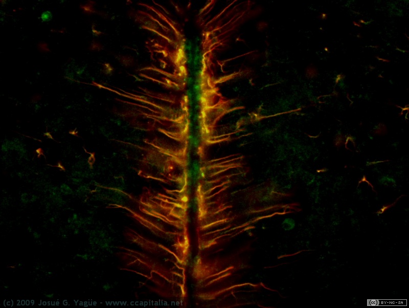 Mo12 tanicitos hipota acris y GFAP 20x