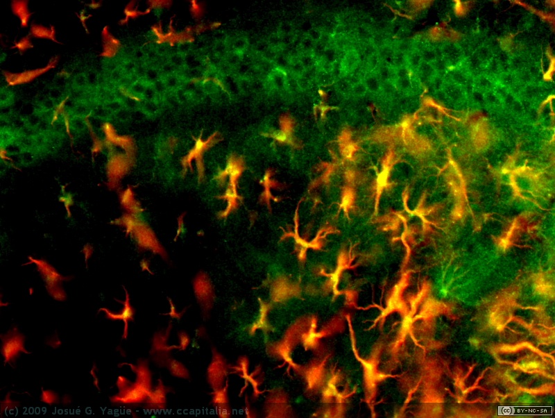 Mo15 hipo lesion CA1 arriba y radiatum de CA1 abajo acris y GFAP 20x