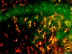 Mo15 hipo lesion CA1 arriba y radiatum de CA1 abajo acris y GFAP 20x