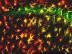 Mo7  hipo lesion CA1 arriba y radiatum de CA1 abajo acris y GFAP 20x