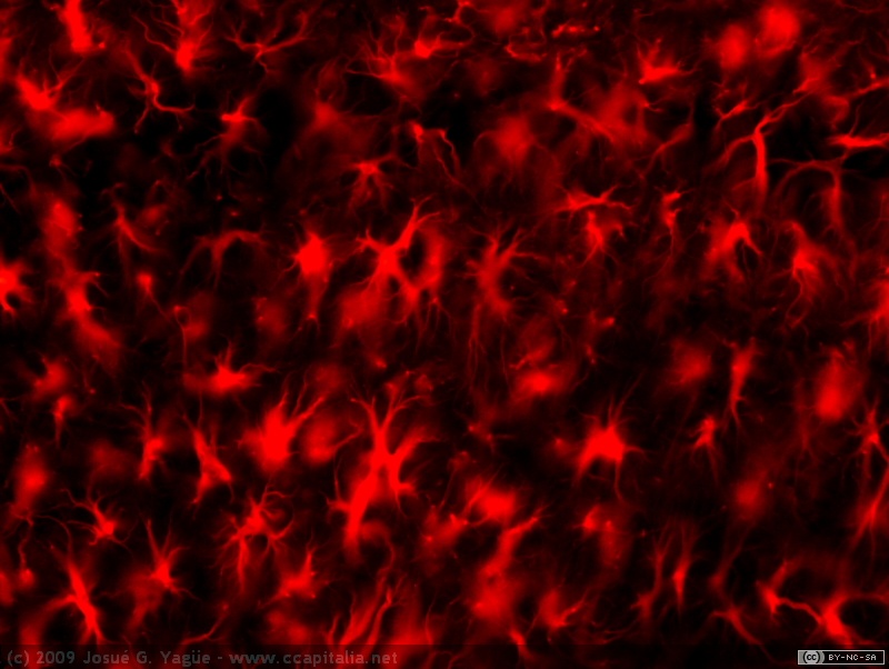 Mo7  hipo lesion CA1 arriba y radiatum de CA1 abajo GFAP 20x