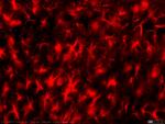 Mo7  hipo lesion CA1 arriba y radiatum de CA1 abajo GFAP 20x