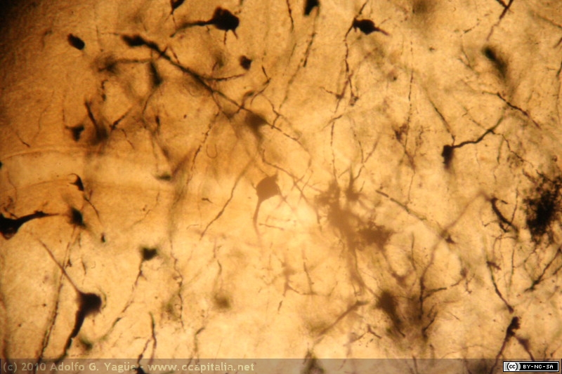 Corteza Cerebral - Gato - Golgi (4)