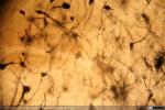 Corteza Cerebral - Gato - Golgi (4)