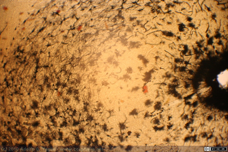 Corteza Cerebral - Gato - Golgi (5)