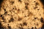 Corteza Cerebral - Gato - Golgi (6)