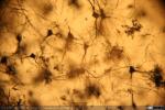 Corteza Cerebral - Gato - Golgi (7)