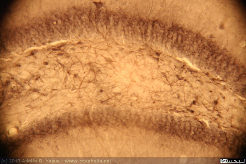 Cerebro Ratón - Corte Coronal - Hipocampo - Aromatasa (3)