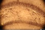 Cerebro Ratón - Corte Coronal - Hipocampo - Aromatasa (3)