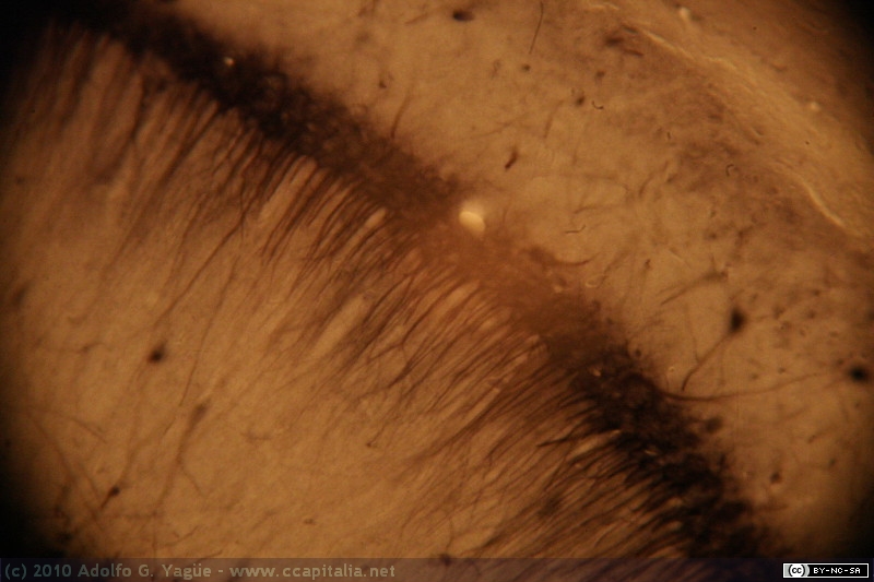 Cerebro Ratón - Corte Coronal - Hipocampo - Aromatasa (4)