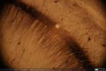 Cerebro Ratón - Corte Coronal - Hipocampo - Aromatasa (4)