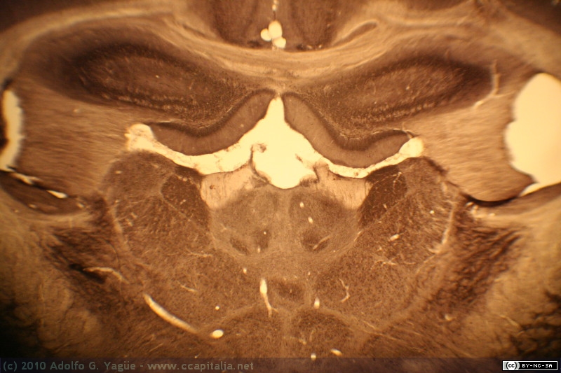 Cerebro Ratón - Corte Coronal - Aromatasa (1)